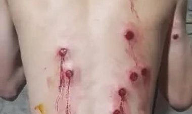 Dos policías detenidos por haber baleado a un joven por la espalda