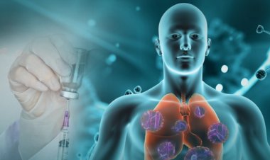 Día de la Tuberculosis: Salud organiza actividades de promoción y prevención