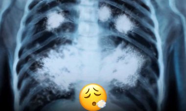 Las Aterradoras Consecuencias de Usar VAPE a los 20 Años