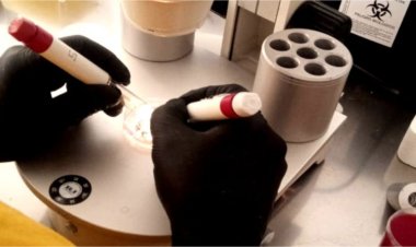 Fertilidad: se realizaron las primeras punciones foliculares en el Hospital Rawson