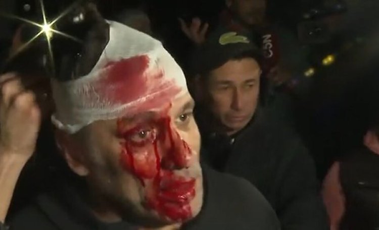 Le partieron la cara a un periodista de América TV en el acto de Javier Milei en Moreno