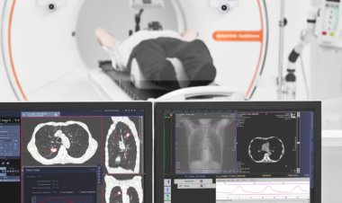 El Hospital Marcial Quiroga lanzó un programa gratuito de detección temprana de cáncer de pulmón