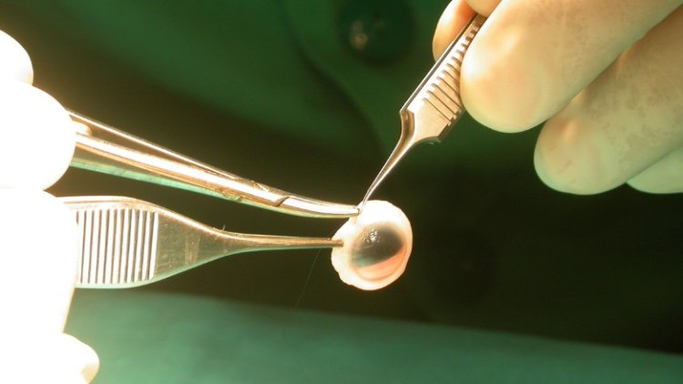 El Hospital Marcial Quiroga duplicó las donaciones para trasplante de tejidos