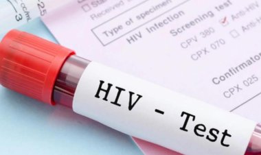 Condenaron a un hombre por contagiar con HIV a su ex pareja