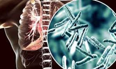 Aumentaron un 38% los casos de tuberculosis en Argentina