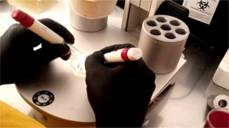 Fertilidad: se realizaron las primeras punciones foliculares en el Hospital Rawson