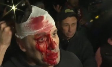 Le partieron la cara a un periodista de América TV en el acto de Javier Milei en Moreno