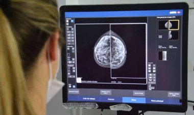 El Marcial Quiroga realizará mamografías sin turno para la detección temprana