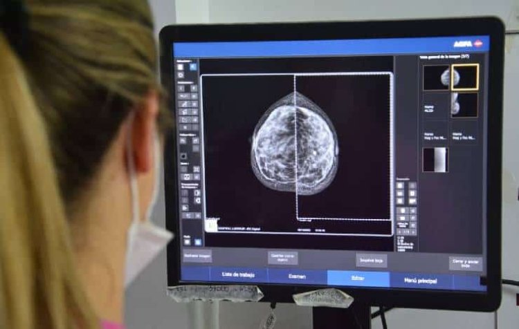 El Marcial Quiroga realizará mamografías sin turno para la detección temprana