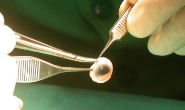 El Hospital Marcial Quiroga duplicó las donaciones para trasplante de tejidos