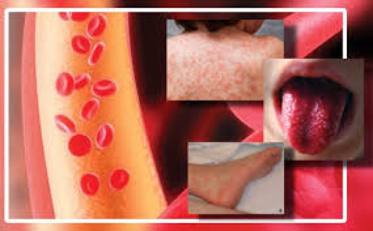 Enfermedad de Kawasaki: qué es y a quiénes afecta